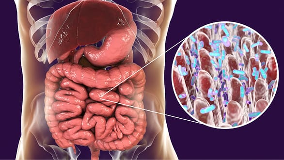 leaky gut diet plan: intestinal permeability